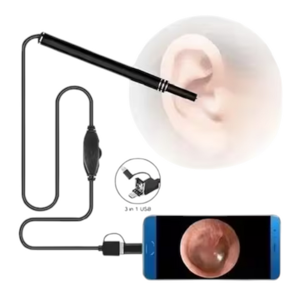 Endoscopio con Cámara Negro Otoscopio para Oídos 6 Led