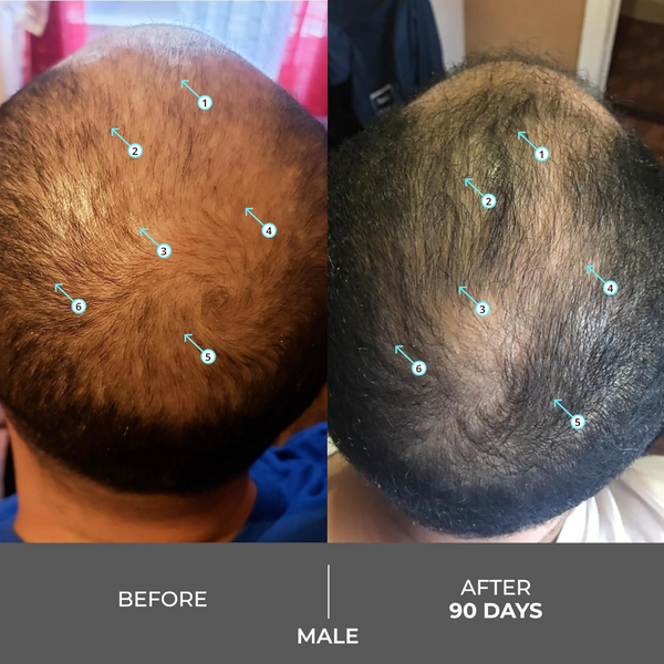 Revita Extra Shampoo Anticaída Para Densidad Capilar 205m