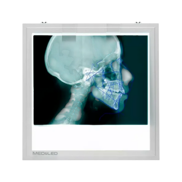 Negatoscopio led 30x28 para encefalometria con portaplacas